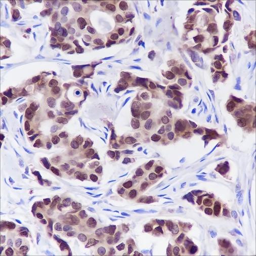 Recombinant FOXA1 Monoclonal Antibody - 2