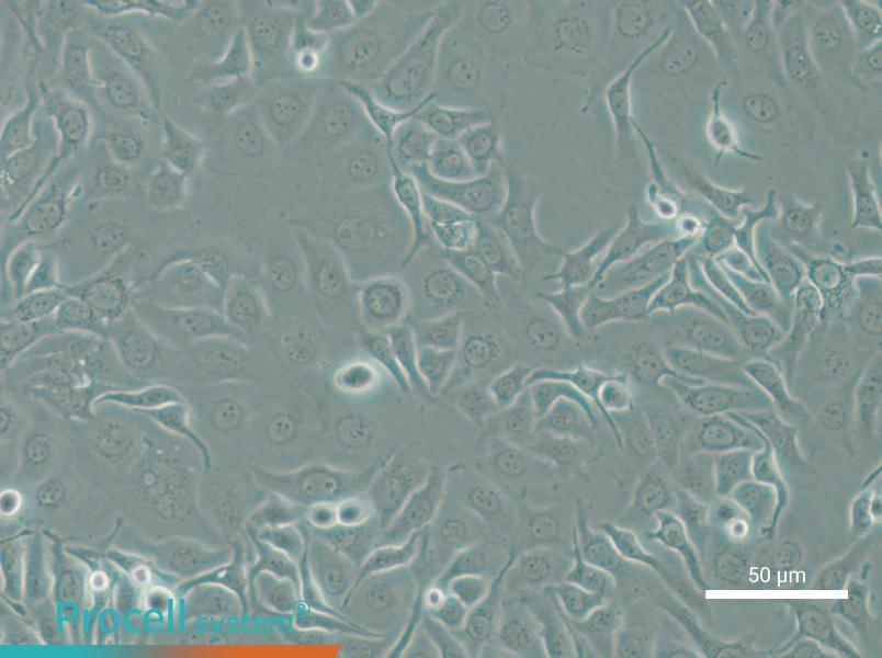 HCC1143 - 4