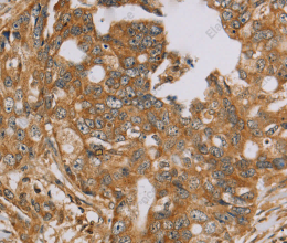 NDUFA10 Polyclonal Antibody - 3