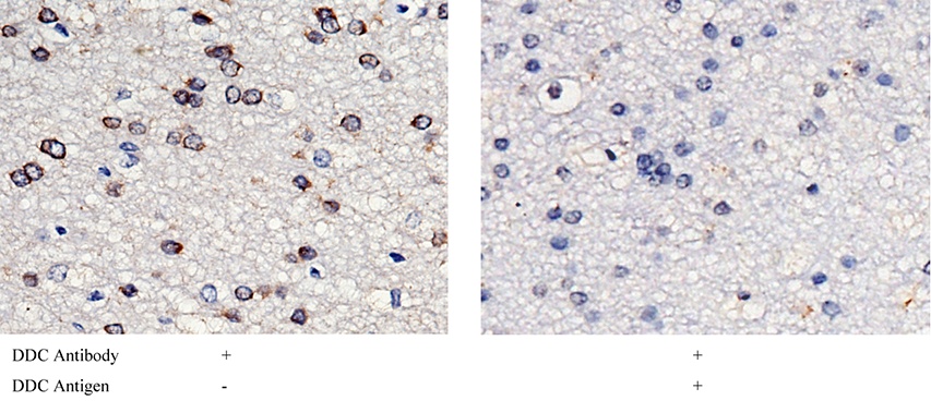 Recombinant DOPA Decarboxylase/DDC Monoclonal Antibody-searchlist-1