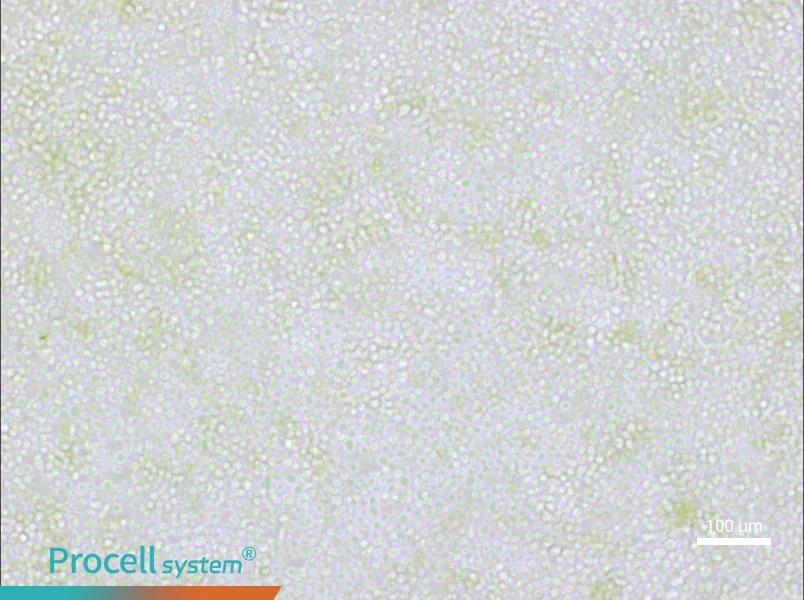 OKT 11 Cell Complete Medium - 3