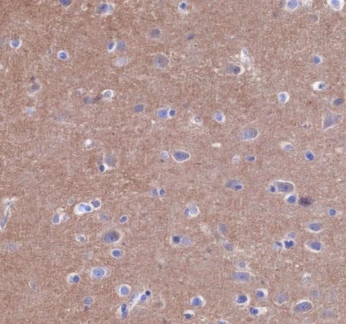 Recombinant Bcr Monoclonal Antibody - 2