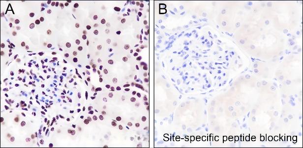 Recombinant Histone H4 (Acetyl Lys77) Monoclonal Antibody - small - 4