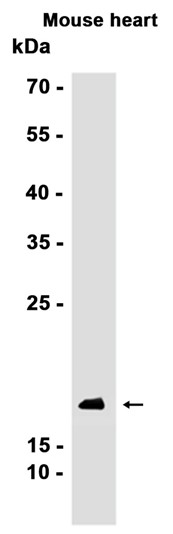 Recombinant 4E-BP1/EIF4EBP1 Monoclonal Antibody - 2