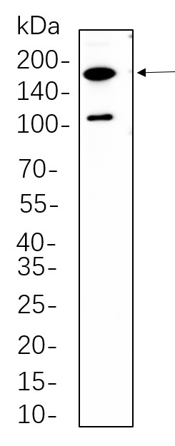 Recombinant Rictor Monoclonal Antibody-searchlist-1