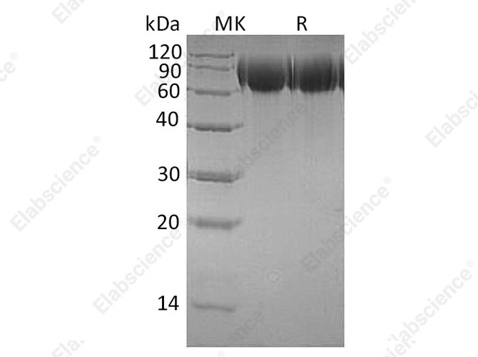 Recombinant Human TrkB/NTRK2 Protein (His Tag) - 1