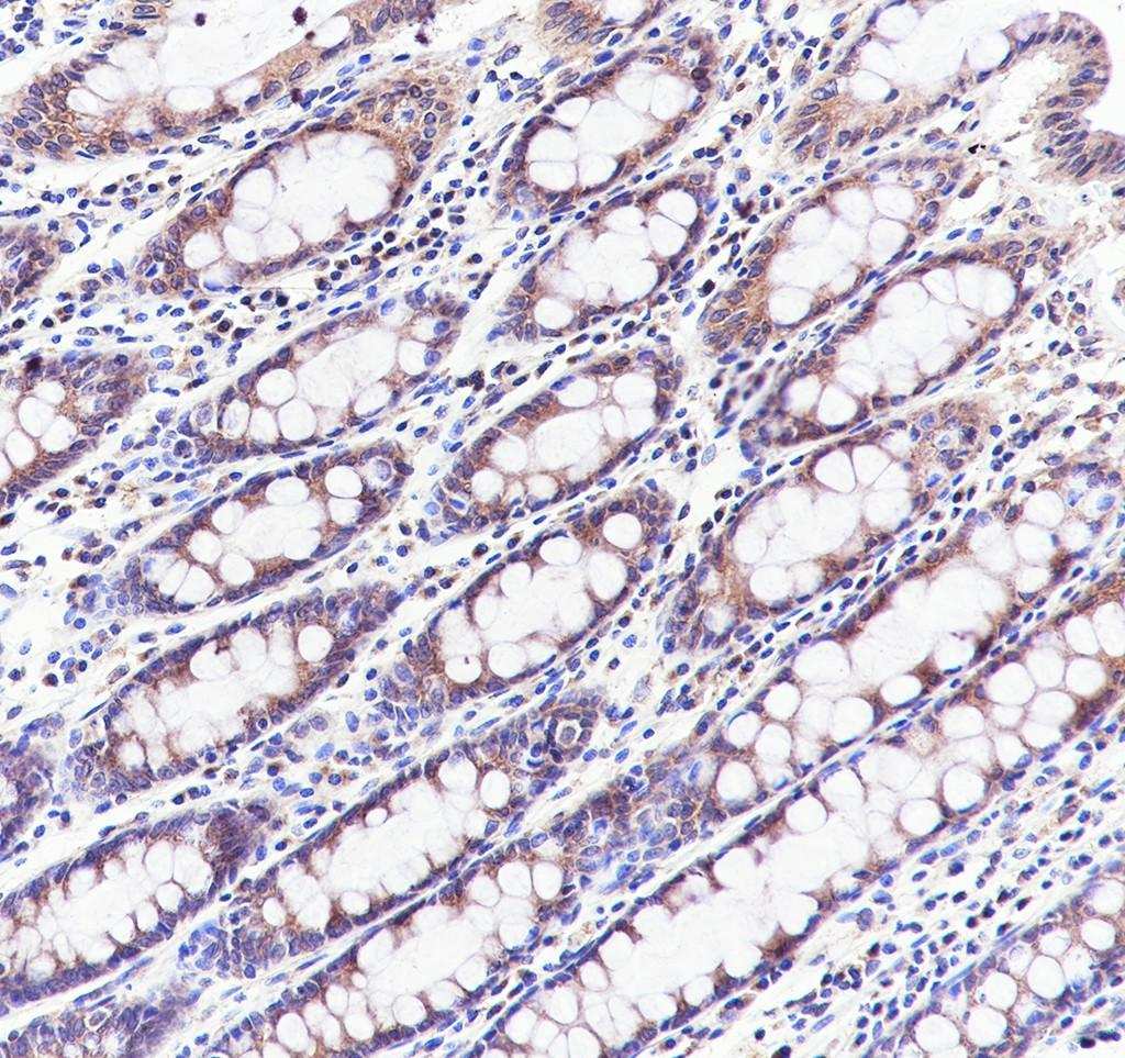 Recombinant GOLGA2/GM130 Monoclonal Antibody - small - 2