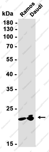 Recombinant Proteasome 20S LMP2 Monoclonal Antibody - 2