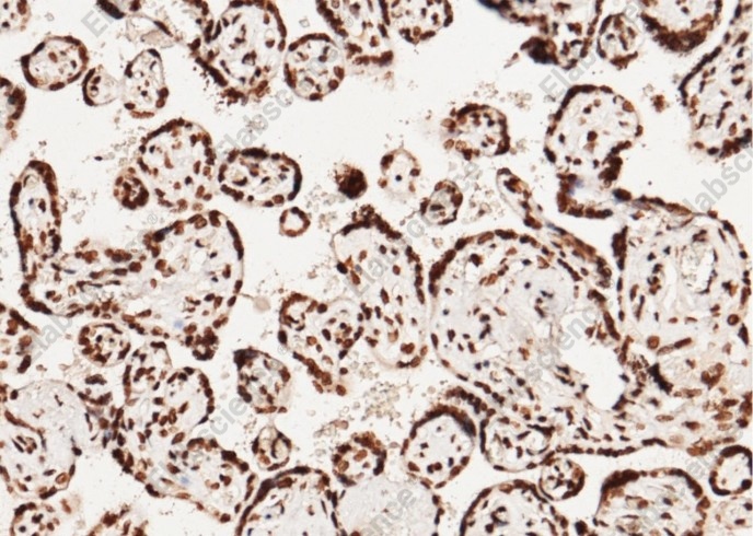 CCNE1/Cyclin-E1 Monoclonal Antibody - 1