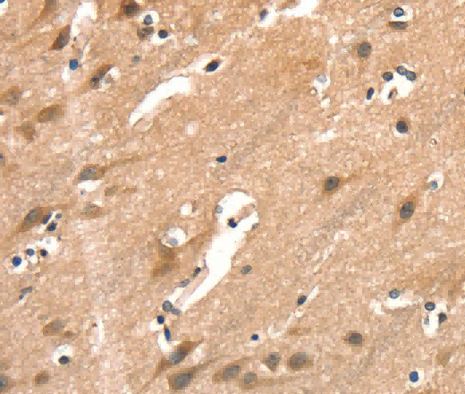 AIMP1 Polyclonal Antibody - 3