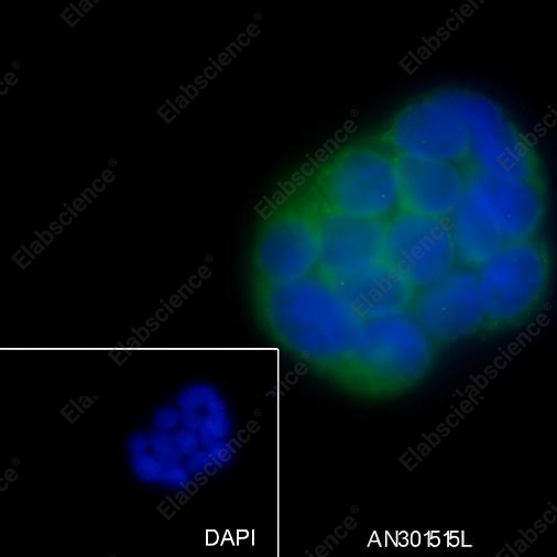 Recombinant EPHB4 Monoclonal Antibody - 2