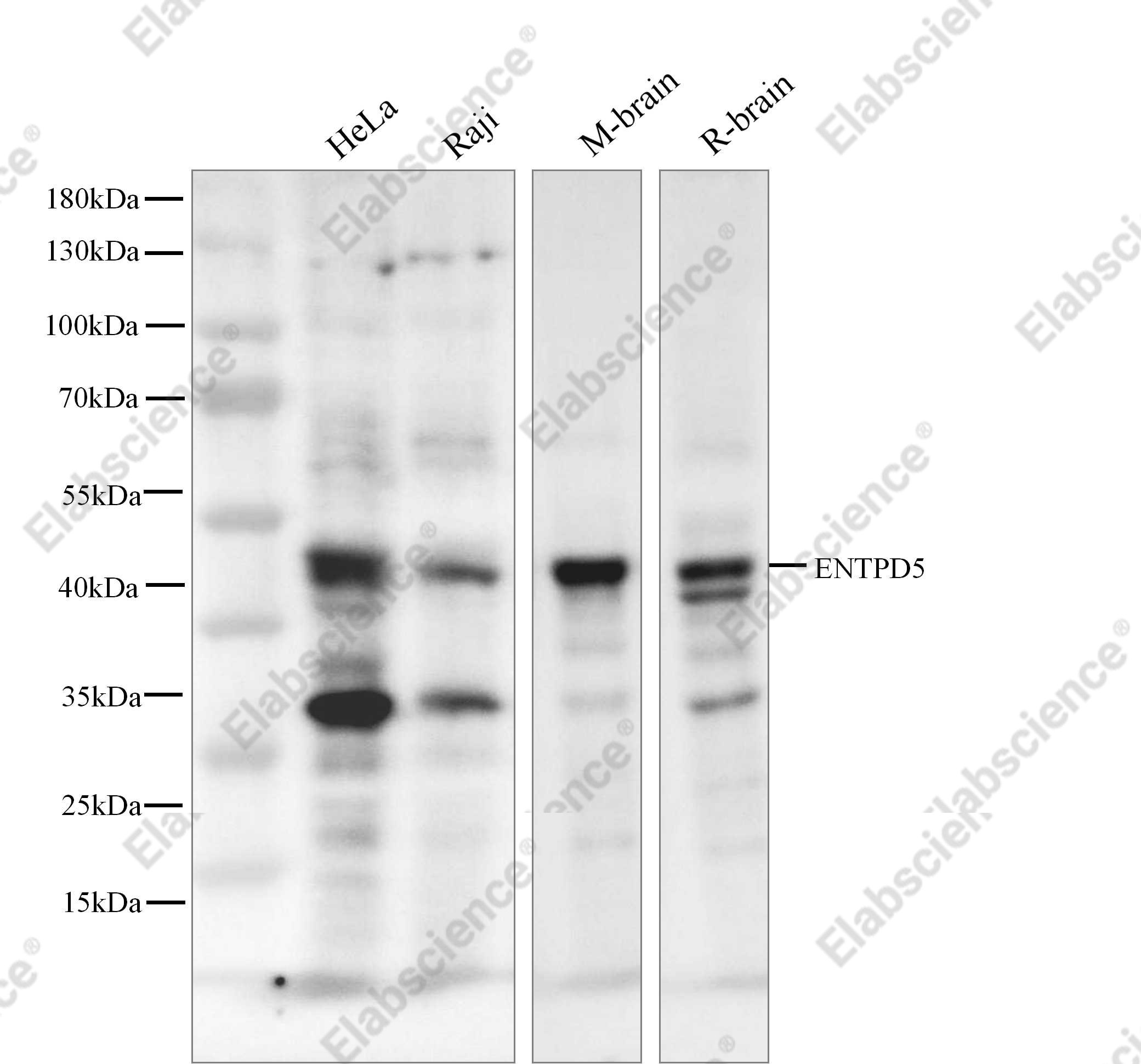 Recombinant ENTPD5 Monoclonal Antibody - 2