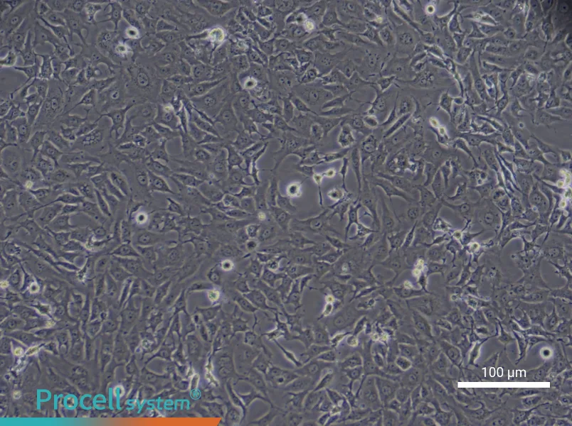 Human Type II Alveolar Epithelial (Primary cell immortalization) Cell Complete MediumHuman Type II Alveolar Epithelial (Primary cell immortalization) Cell Complete Medium - 3