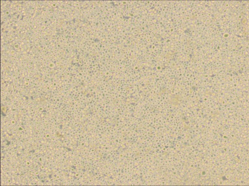 U266 [U266B1] Cell Complete Medium - 2