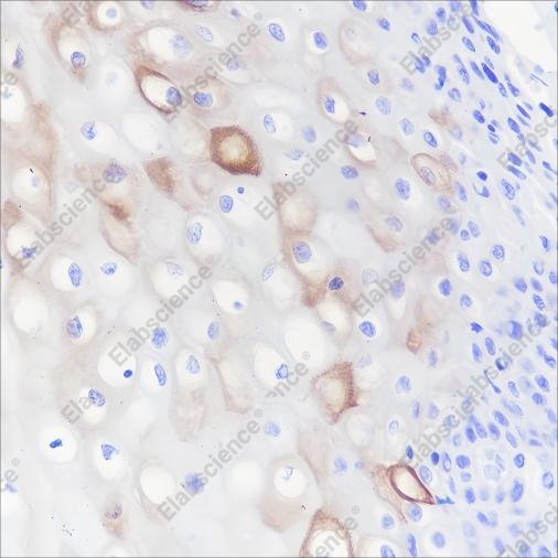 Recombinant Keratin 4 Monoclonal Antibody - 2