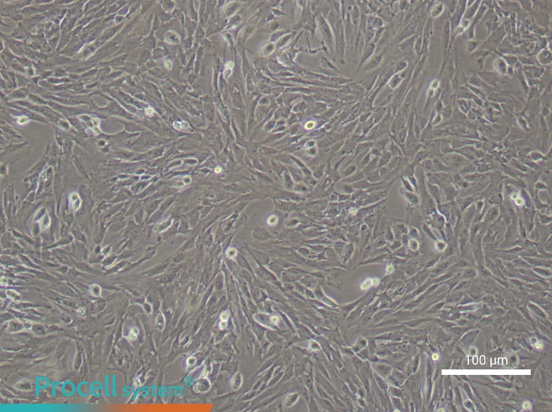 Mouse Bladder Fibroblast Complete Medium - 1