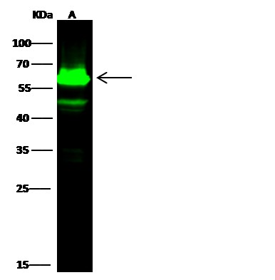 Recombinant Cytokeratin 5/KRT5 Monoclonal Antibody - small - 2