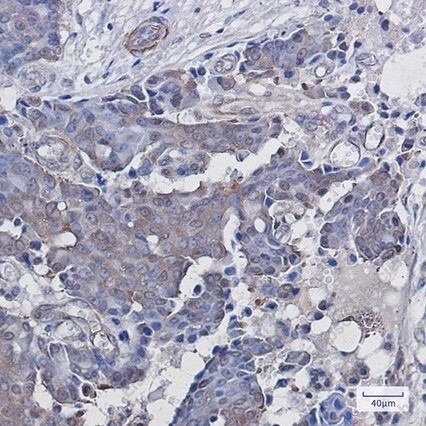 Recombinant ADRM1 Monoclonal Antibody - 3