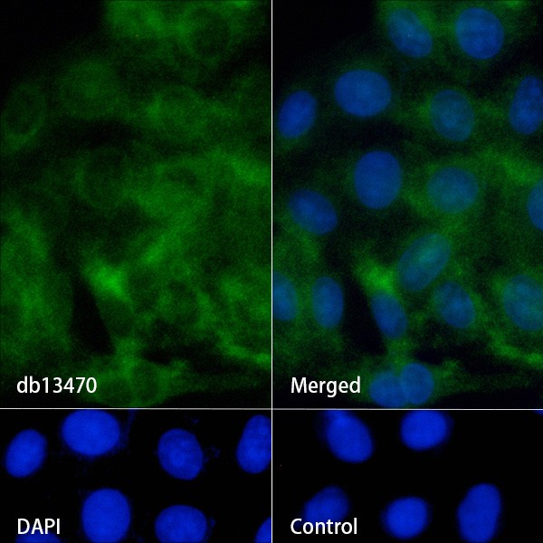 Recombinant TFPI Monoclonal Antibody - 2