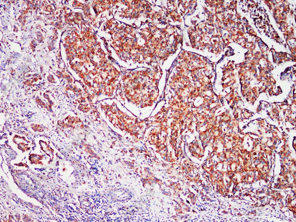 Recombinant LAMP1/CD107a Monoclonal Antibody - 2