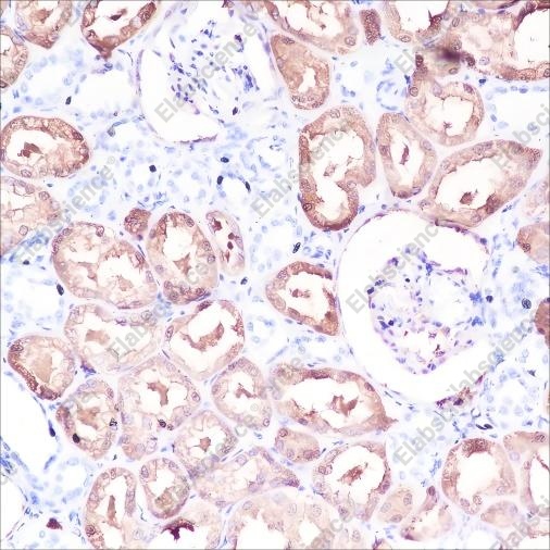 Recombinant DOPA Decarboxylase/DDC Monoclonal Antibody - 2