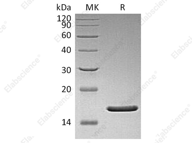 Recombinant Human FGF-2/FGF basic/FGFb Protein (aa 1-155)(Q65I,C96S,N111G) - 1