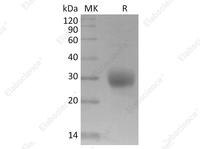 Recombinant SARS-CoV-2 Spike Protein (RBD, His Tag) - 1