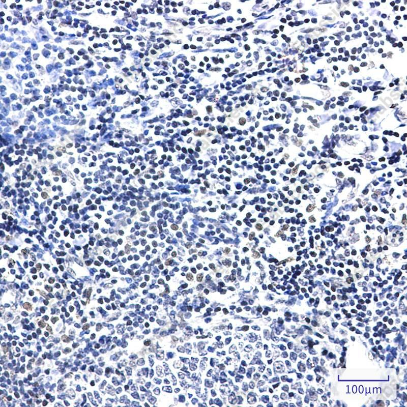 Recombinant PIM1 Monoclonal Antibody - 2