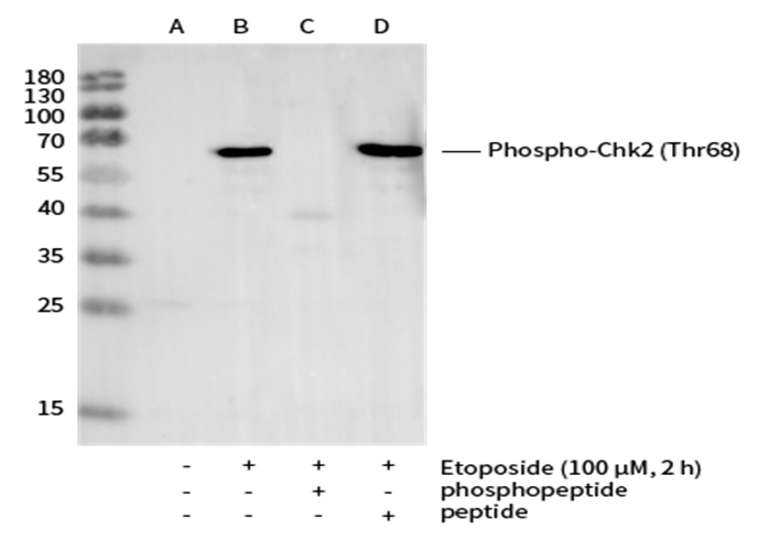 Recombinant Phospho-Chk2 (Thr68) Monoclonal Antibody