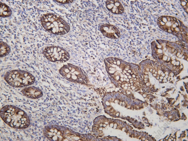 Recombinant MAO-A Monoclonal Antibody - 1