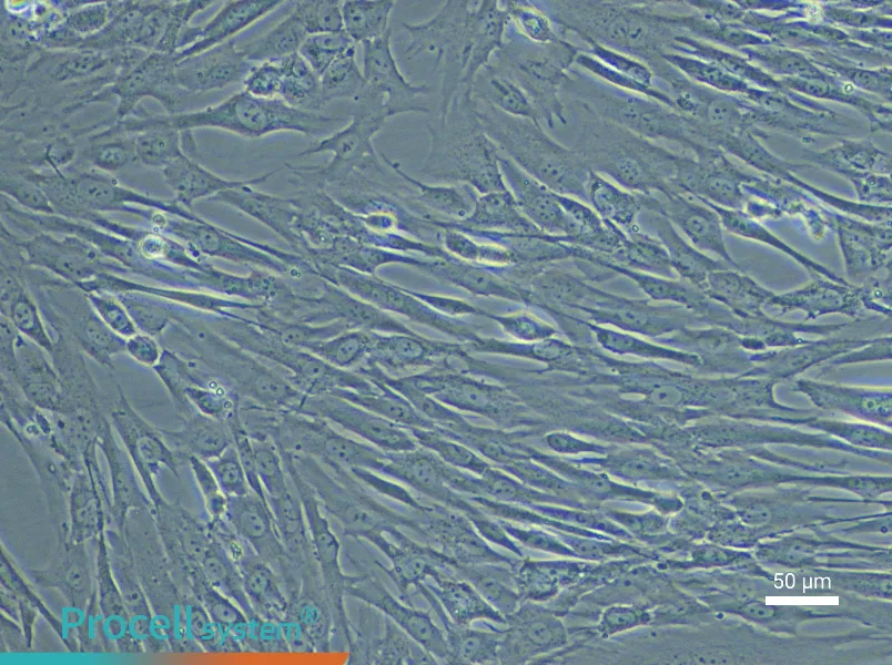Human Uterine Fibroblast Complete Medium - 5