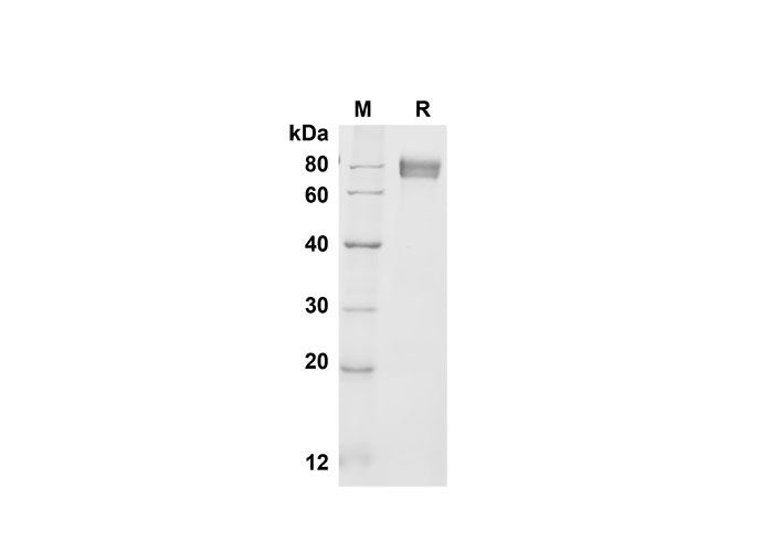 Recombinant Mouse IFN-γ Protein(GST Tag)-产品推荐-1
