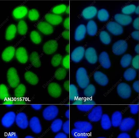 Recombinant JunB Monoclonal Antibody - 3