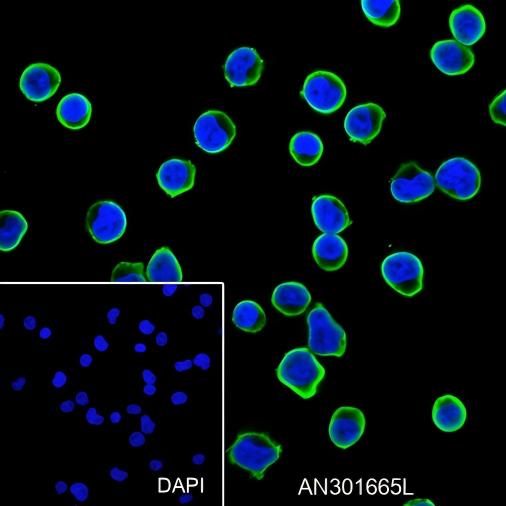 Recombinant Stathmin Monoclonal Antibody - small - 6
