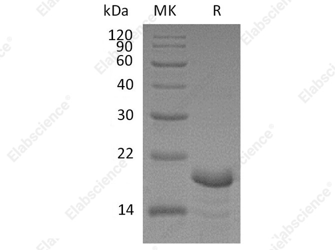 Recombinant Human Calcineurin B/CNB Protein (His Tag) - 1