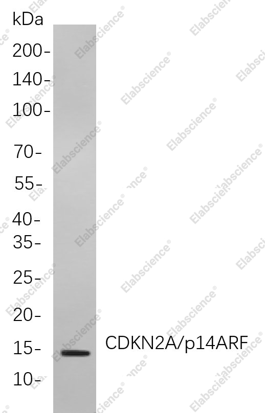 Recombinant CDKN2A/p14ARF Monoclonal Antibody - 1
