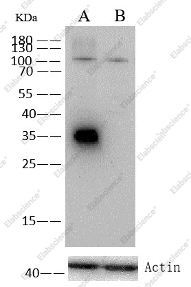 CD20/MS4A1 Monoclonal Antibody - 4
