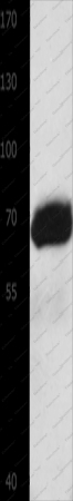 AFP Polyclonal Antibody - 1