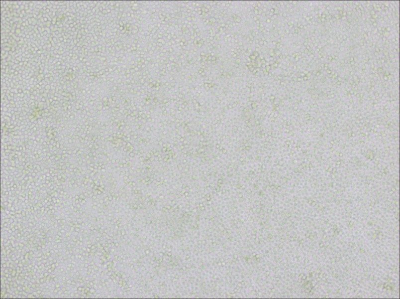 P388D1 Cell Complete Medium-searchlist-1