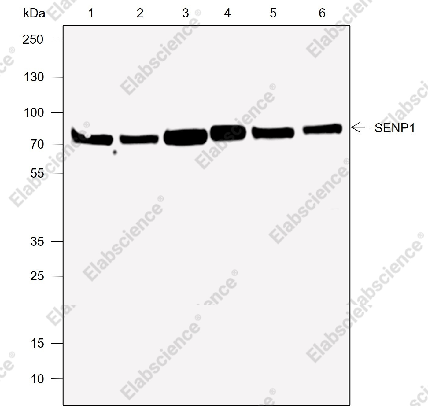Recombinant SENP1 Monoclonal Antibody - 1