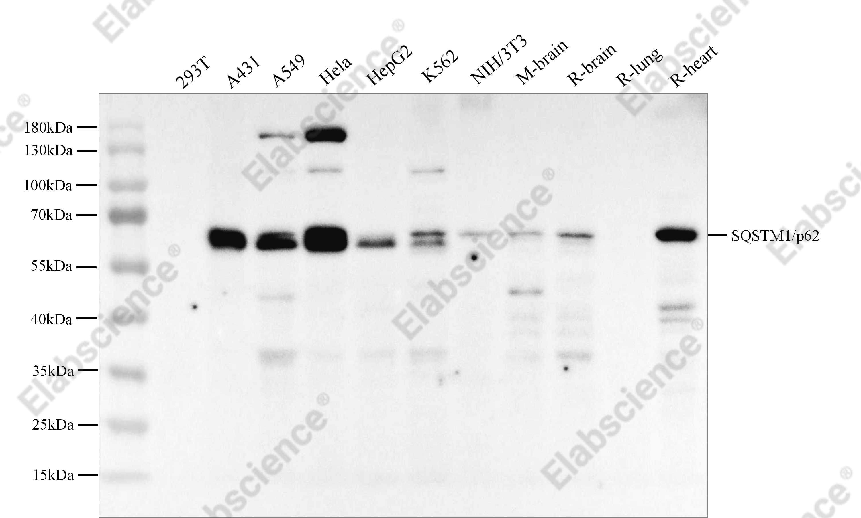 Recombinant SQSTM1/p62 Monoclonal Antibody - 2