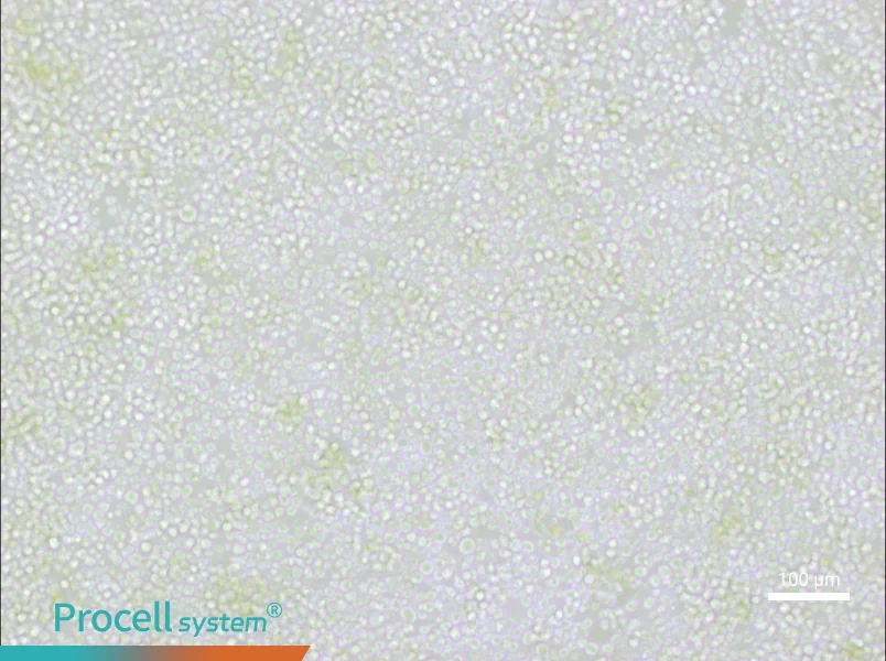 OKT 11 Cell Complete Medium - 2