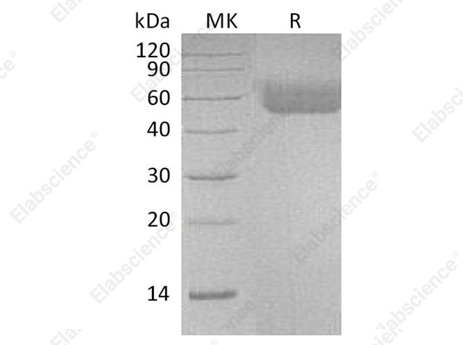 Recombinant Human IL1R1/CD121a Protein (His Tag) - 1