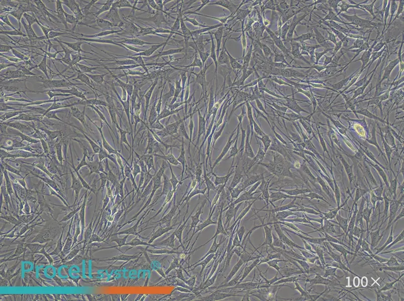 OP9 Cell Complete Medium - 1