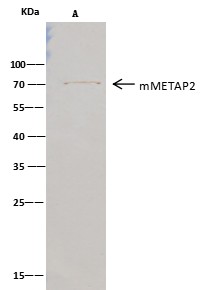 Recombinant MAP2/METAP2 Monoclonal Antibody - small - 2