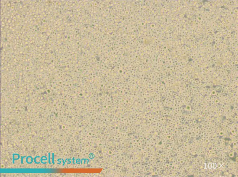 U266 [U266B1] Cell Complete Medium - 3