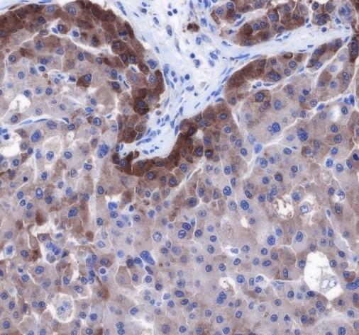 Recombinant FGL1 Monoclonal Antibody-searchlist-2