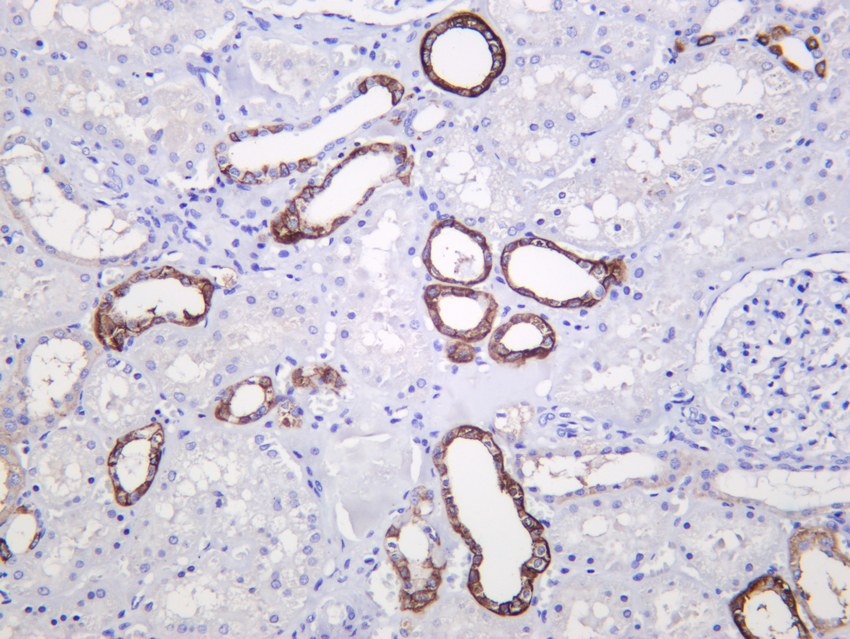 Recombinant Acetyl Coenzyme A Carboxylase Monoclonal Antibody - 2