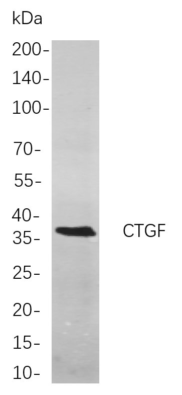 Recombinant CTGF Monoclonal Antibody-searchlist-1
