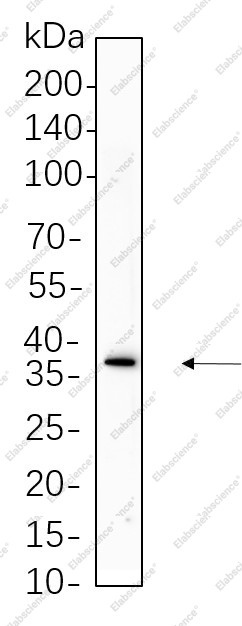 Recombinant Podoplanin Monoclonal Antibody - 1
